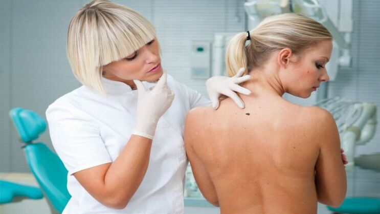 背中の乳頭腫の検査